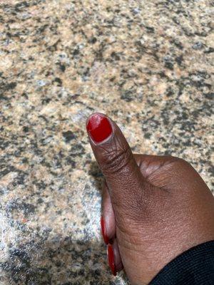 Broken nail with peeling polish.