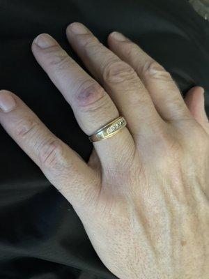 Wedding ring repaired after having been cut off due to injury.