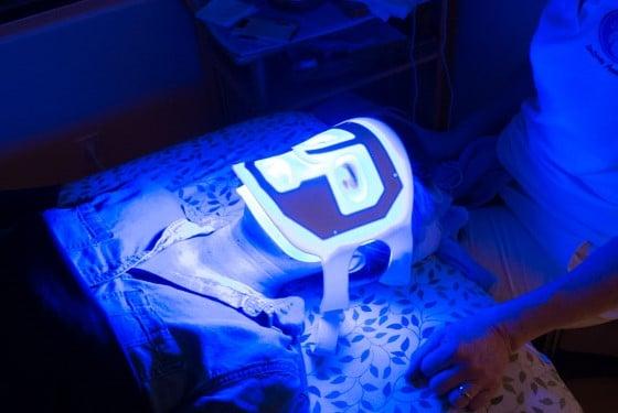 Blue LED kills acne bacteria.