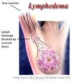 Breast lymphatic drainage