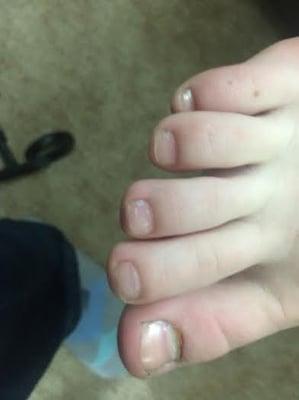 This is what a pedicure with clear polish look like a foxy nails. .  Note the old nail polish left in the corners.