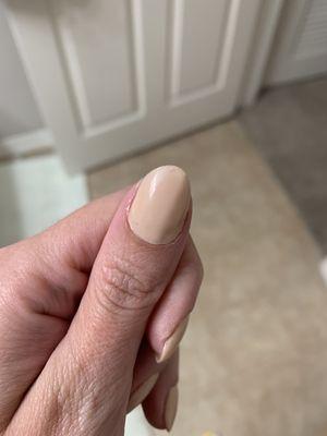 My cuticle???? What is this blob???