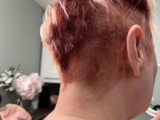 Uneven shave job, also look at the hair dye left on her neck.