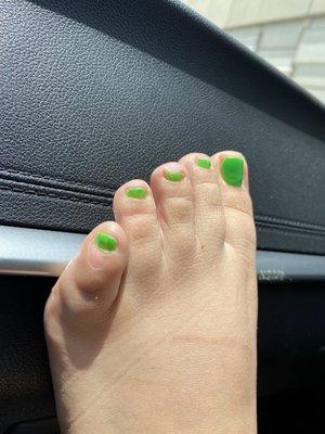 Bad pedicure