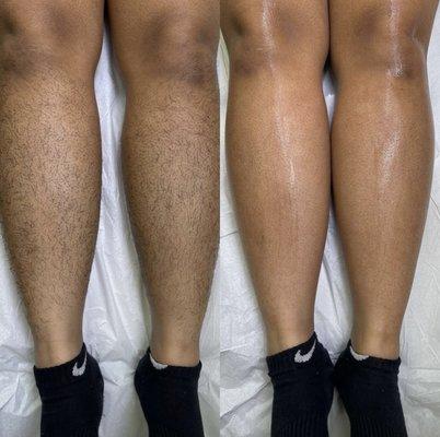 Before and After Leg Wax. Lasts 4-6 weeks