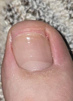 My big toe after my pedicure.