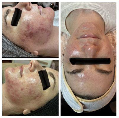 SkinHappy Acne Clinic
Success!