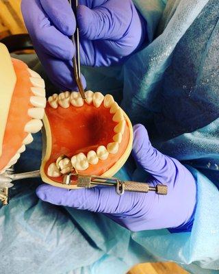 MDS Dental Assisting Academy students learning how to isolate with toffelmire matrix band and wedges