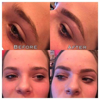 Brow shaping