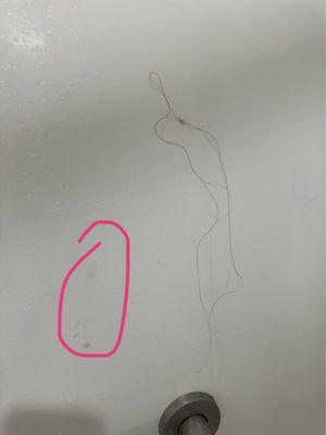 Hair in shower and mucous on shower wall. (Circled).