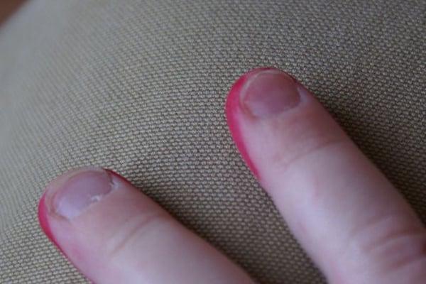 My daughter's index finger completely healed. It was almost severed. FYI the red is just  marker ;)