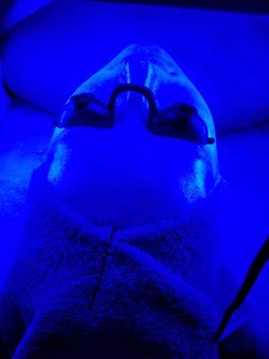 Blue LED Light Therapy for acneic skin