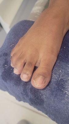 "C"  1st time at our salon. Shes getting acrylics on her 2 big toes. this  is a before photo