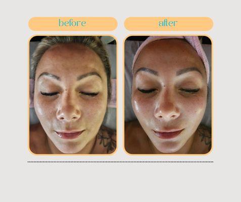 Before and after photos of the pumpkin enzyme facial