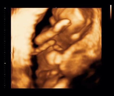 16 week 3d ultrasound scan