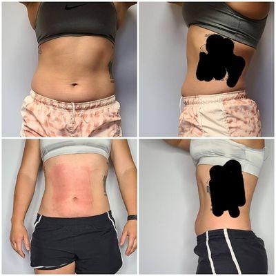 Cavitation results