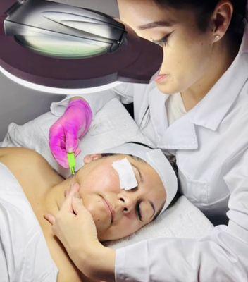 Dermaplaning