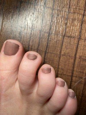 Toe nails