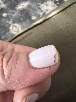 Cuticle nail infection