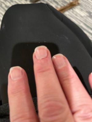 Cut my cuticle to bleed twice