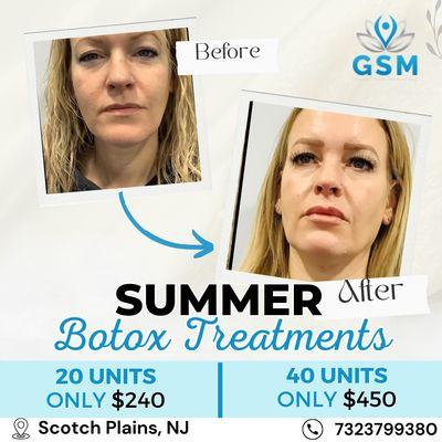 Prepare to glow with our exclusive Summer Botox Treatment. Shine brighter than the summer sun!