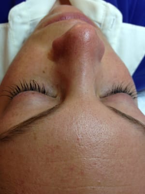 Eyelash Extension