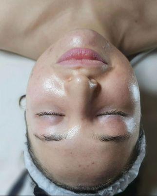 Rejuvenating facial