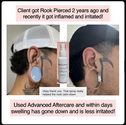 Advanced Aftercare helps reduce swelling, irritation and keloids. 
Available in shop or online