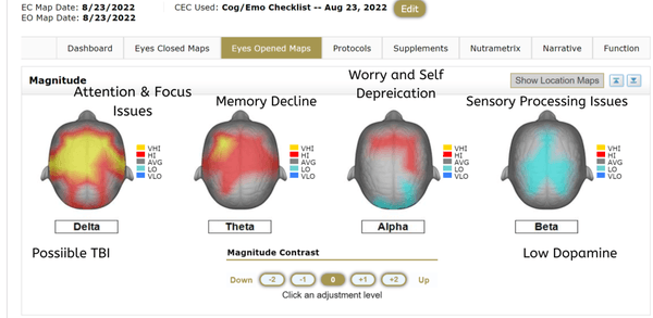 your "brain map" report of findings may look like this...