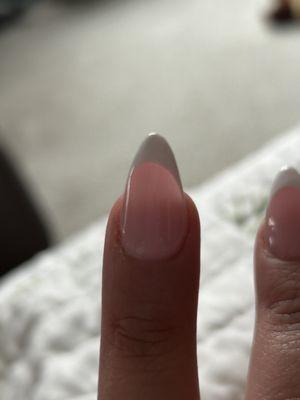 Crooked nail