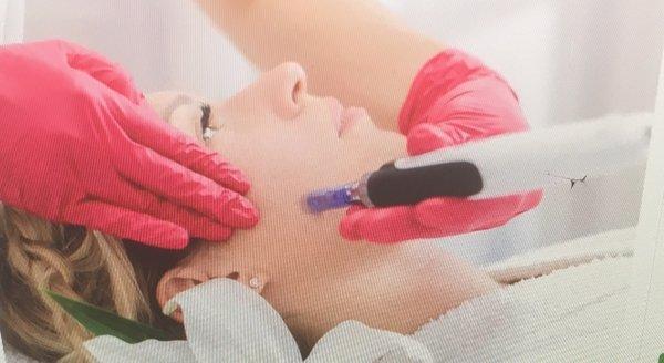 HUDSON LASER SPA
  MICRONEEDLNG WITH COLLAGEN AND VITAMINS INFUSION