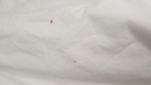 Red apots on sheet (blood?)