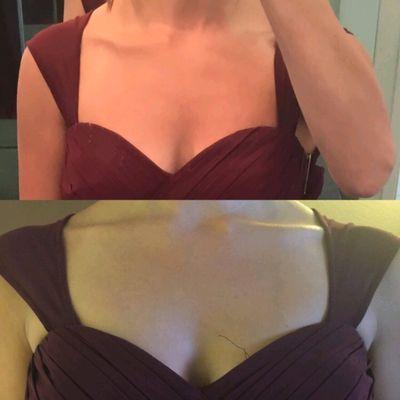 Before alterations (top) & after (bottom) with uneven straps attached at an angle altering the design of the dress.