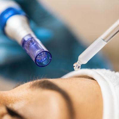 Micro needling services