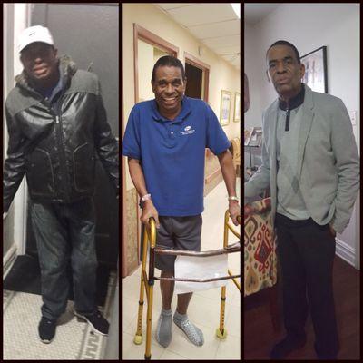 Before and after pics of my dad's knee replacements. Thanks to Forest View Rehab & staff for a job well done.  The Ogiste family, Much Love!