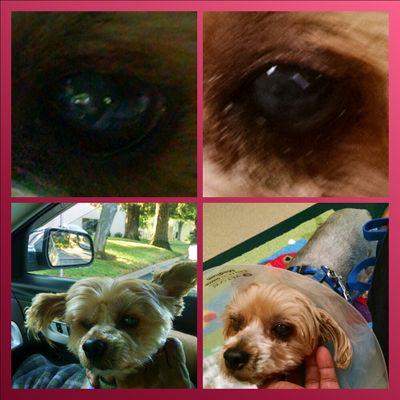 Ardy left eye before on left, after on right post cataract surgery.