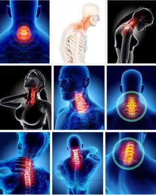 CRANIOSACRAL FOR Neck Pain and Central Nervous System Integration