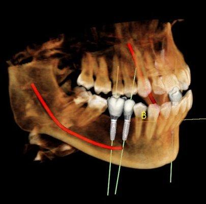 Sarang Dental Clinic