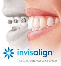 We are a proud provider of Invisalign