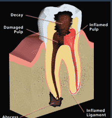 Endodontic Associates At Hanson Pl PC