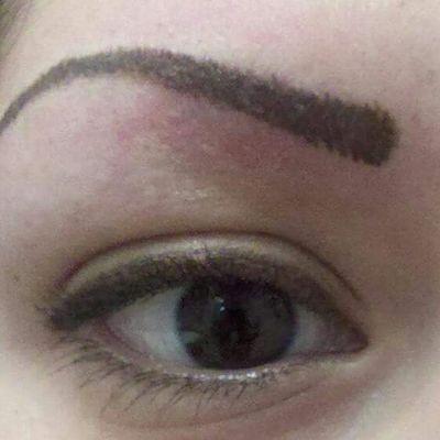 Eyebrow Procedure