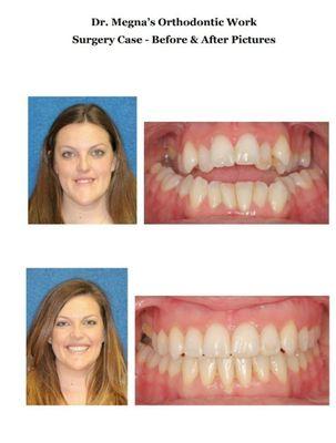 Dr. Megna works hand in hand with the Oral Surgeon to create beautiful,  transformed SMILES!