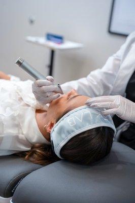 Microneedling treatment is a great choice for those with acne scars and conditions resulting in uneven skin texture or appearance.