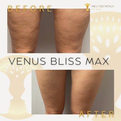 Venus Bliss Max