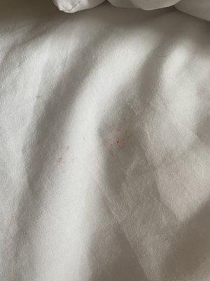 blood stain on bed sheets. Not pictured was scab and blade of grass that was between the flat sheet and top sheet upon 2am arrival