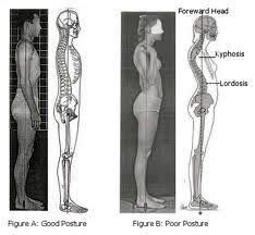 A look at how Rolfing restores posture and health