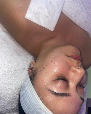 Mid dermaplane facial