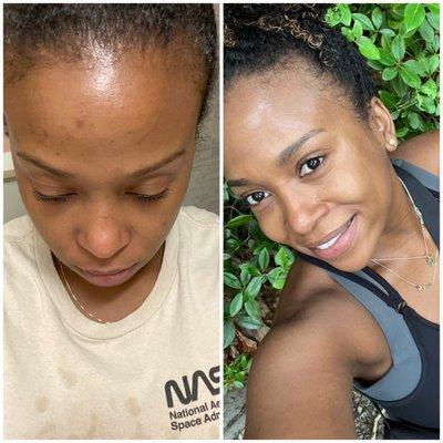 My before & after!