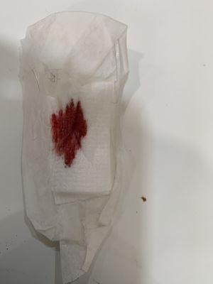 cotton after removing the tape few hours after blood draw