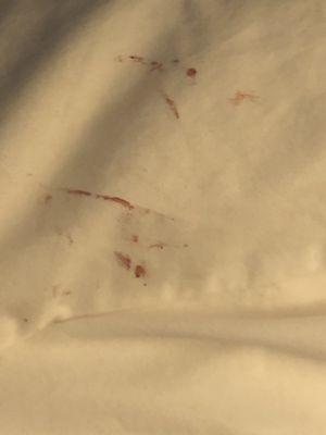 Blood on the sheets